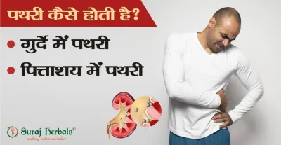 पथरी कैसे होती है? (गुर्दे की पथरी, पित्ताशय की पथरी)