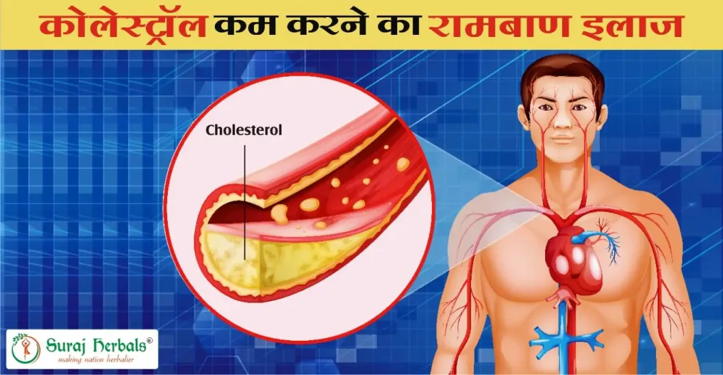 कोलेस्ट्रॉल कम करने का आयुर्वेदिक इलाज